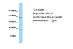 NALP12 Antibody, Novus Biologicals 100 &mu;L | Buy Online | Novus Biologicals | Fisher Scientific